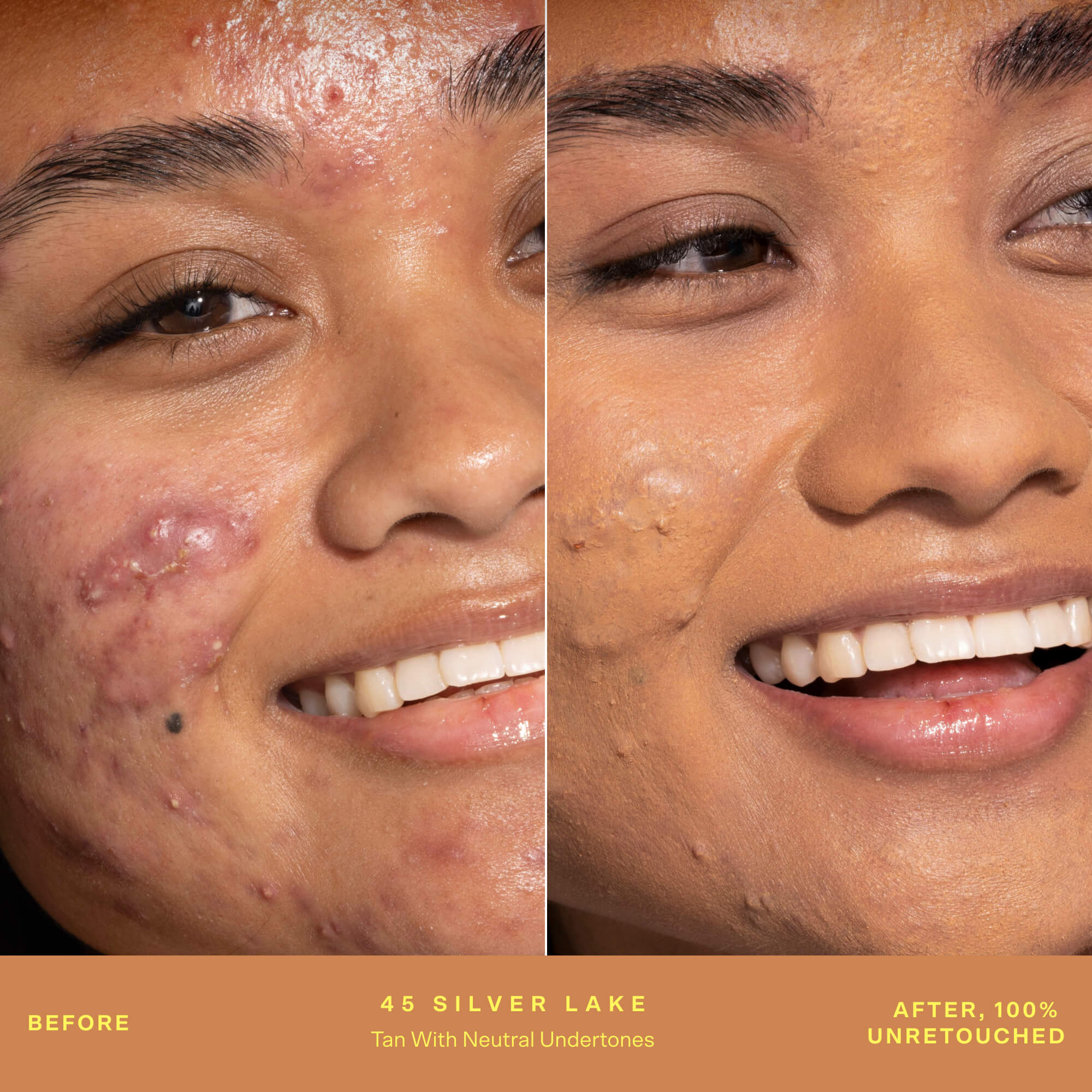 SunnyDays™ Tinted SPF 30 - Image 24