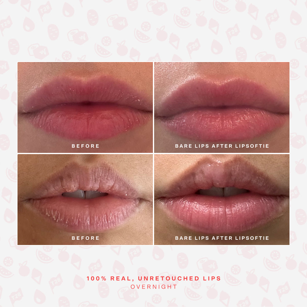 LipSoftie® Lip Treatment Set - Image 6